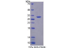 SDS-PAGE analysis of Human MED8 Protein. (MED8 Protein)
