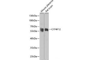 Western blot analysis of extracts of various cell lines using CYP4F12 Polyclonal Antibody at dilution of 1:1000.