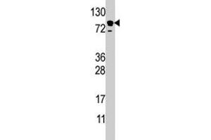 Western blot analysis of EPS15 polyclonal antibody  in HL-60 cell line lysate (35 ug/lane). (EPS15 Antikörper  (C-Term))