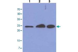 Western blot analysis of cell lysates (each 40 ug) by MRRF monoclonal antibody, clone AT7D10  (1:1000). (MRRF Antikörper  (AA 56-262))