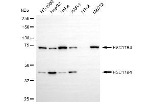 Western blotting analysis using HSD17B4 antibody (ABIN7799015). (HSD17B4 Antikörper)