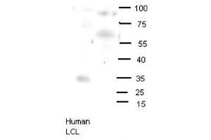 Western Blotting (WB) image for anti-Oligodendrocyte Lineage Transcription Factor 2 (OLIG2) (N-Term) antibody (ABIN2777314)