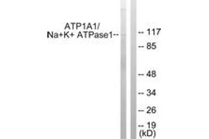 Western Blotting (WB) image for anti-Sodium Potassium ATPase, alpha1 (ATP1A1) (AA 15-64) antibody (ABIN2888908) (ATP1A1 Antikörper  (AA 15-64))
