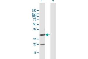 Western Blot analysis of DUT expression in transfected 293T cell line by DUT MaxPab polyclonal antibody. (Deoxyuridine Triphosphatase (DUT) (AA 1-252) Antikörper)