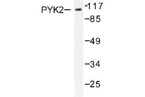 Image no. 1 for anti-PTK2B Protein tyrosine Kinase 2 beta (PTK2B) antibody (ABIN271907) (PTK2B Antikörper)