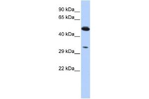 WB Suggested Anti-PIK3IP1 Antibody Titration:  0. (PIK3IP1 Antikörper  (Middle Region))