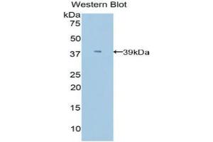 Western blot analysis of the recombinant protein. (APOC1 Antikörper  (AA 30-88))
