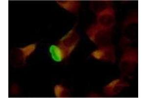 Immunofluorescence (IF) image for anti-Herpes Simplex Virus Type 2 ICP8 (HSV2 ICP8) antibody (ABIN265565) (HSV2 ICP8 Antikörper)
