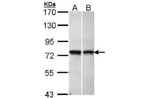 WB Image Sample (30 ug of whole cell lysate) A: A431 , B: Hela 7. (VPS51 Antikörper  (C-Term))