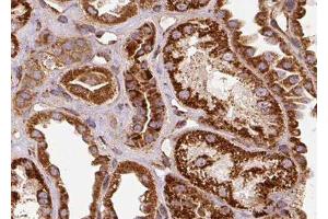 ABIN6278260 at 1/100 staining Human kidney tissue by IHC-P. (Selenoprotein P Antikörper)