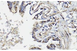 Immunohistochemistry of paraffin-embedded Human lung using WASF3 Polyclonal Antibody at dilution of 1:100 (40x lens). (WASF3 Antikörper)