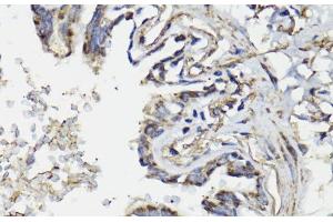 Immunohistochemistry of paraffin-embedded Human lung using WASF3 Polyclonal Antibody at dilution of 1:100 (40x lens).