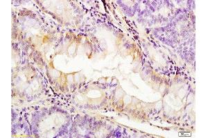 Formalin-fixed and paraffin embedded: rat colitis tissue labeled with Anti-PDGFRA Polyclonal Antibody, Unconjugated  at 1:200, followed by conjugation to the secondary antibody and DAB staining (PDGFRA Antikörper  (AA 1021-1089))