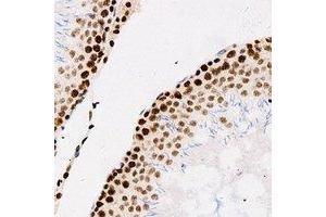 Immunohistochemical analysis of Importin alpha 1 staining in human testis formalin fixed paraffin embedded tissue section. (KPNA2 Antikörper)