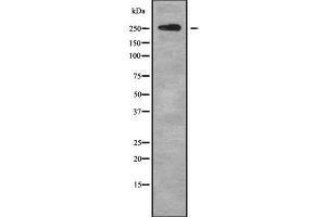 Western blot analysis of ABCA4 using HT29 whole cell lysates (ABCA4 Antikörper  (C-Term))