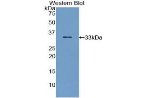 Western blot analysis of the recombinant protein. (IRAK2 Antikörper  (AA 235-521))