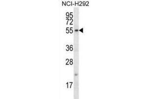 Western Blotting (WB) image for anti-F-Box Protein 15 (FBXO15) antibody (ABIN2996731)