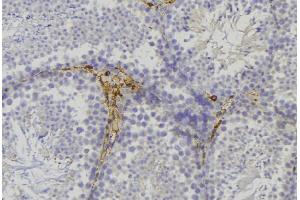 ABIN6276747 at 1/100 staining Mouse testis tissue by IHC-P. (alpha Adducin Antikörper  (C-Term))