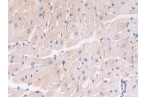 Immunohistochemistry (IHC) image for anti-Thrombospondin 1 (THBS1) (AA 515-671) antibody (ABIN7438112)