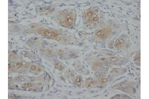 IHC(P): Rat Spleen Tissue. (KRT4 Antikörper)