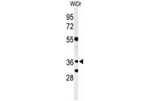 Western blot analysis of NSE4A Antibody (N-term) in WiDr cell line lysates (35µg/lane). (NSMCE4A Antikörper  (N-Term))