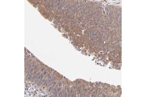 Immunohistochemical staining (Formalin-fixed paraffin-embedded sections) of human urinary bladder with ASB7 polyclonal antibody  shows moderate cytoplasmic positivity in urothelial cells.