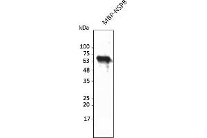 Western Blotting (WB) image for anti-SARS-CoV-2 Non-Structural Protein 8 (NSP8) antibody (ABIN7273001) (SARS-CoV-2 NSP8 Antikörper)