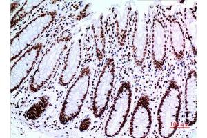 Immunohistochemistry (IHC) image for anti-Tumor Protein P73 (TP73) (Tyr221) antibody (ABIN3187855)