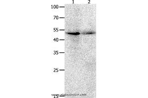 Western blot analysis of Jurkat cell  and human ovarian cancer tissue  , using KLF5 Polyclonal Antibody at dilution of 1:1700 (KLF5 Antikörper)