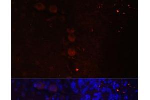 Immunofluorescence analysis of Rat brain using NEFM Polyclonal Antibody at dilution of 1:100. (NEFM Antikörper)