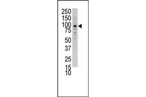 Image no. 1 for anti-Discoidin Domain Receptor tyrosine Kinase 1 (DDR1) (N-Term) antibody (ABIN359897) (DDR1 Antikörper  (N-Term))