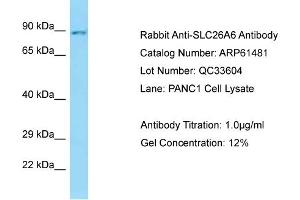 Western Blotting (WB) image for anti-Solute Carrier Family 26, Member 6 (SLC26A6) (C-Term) antibody (ABIN2788820)