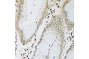 Immunohistochemistry of paraffin-embedded human stomach using ENPEP antibody at dilution of 1:200 (40x lens). (ENPEP Antikörper)