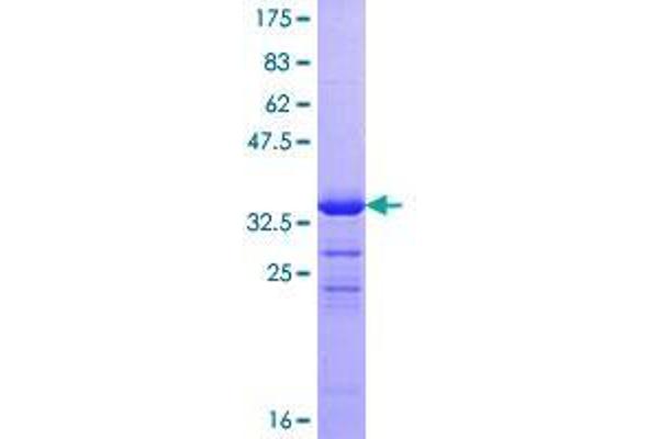 ZNRD1 Protein (AA 1-126) (GST tag)