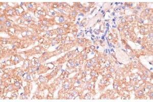 Immunohistochemistry of paraffin-embedded Rat liver using IKK alpha Polyclonal Antibody at dilution of 1:100 (40x lens). (IKK alpha Antikörper)
