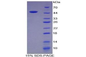 SDS-PAGE (SDS) image for Chromogranin B (Secretogranin 1) (CHGB) (AA 315-482) protein (His tag,GST tag) (ABIN1879887)
