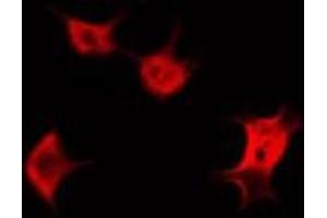 ABIN6266573 staining HeLa by IF/ICC. (KRT20 Antikörper  (C-Term))