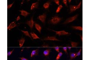Immunofluorescence analysis of C6 cells using DNASE1L1 Polyclonal Antibody at dilution of 1:100. (DNASEX Antikörper)