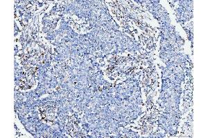 IHC analysis of FACL4/ACSL4 using anti-FACL4/ACSL4 antibody (ABIN7602779). (ACSL4 Antikörper  (C-Term))
