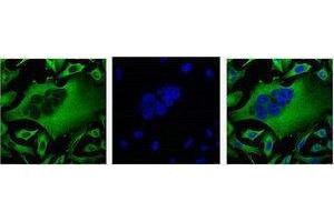 Western Blotting (WB) image for anti-Tubulin, beta (TUBB) antibody (ABIN3178583) (TUBB Antikörper)