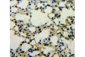 Used in DAB staining on fromalin fixed paraffin-embedded Lung tissue (IL1A Antikörper  (AA 116-270))
