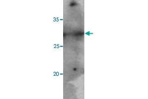 Jurkat cell lysates (40 ug) were resolved by SDS-PAGE, transferred to PVDF membrane and probed with PNMT monoclonal antibody, clone AT1C11  (1:500).