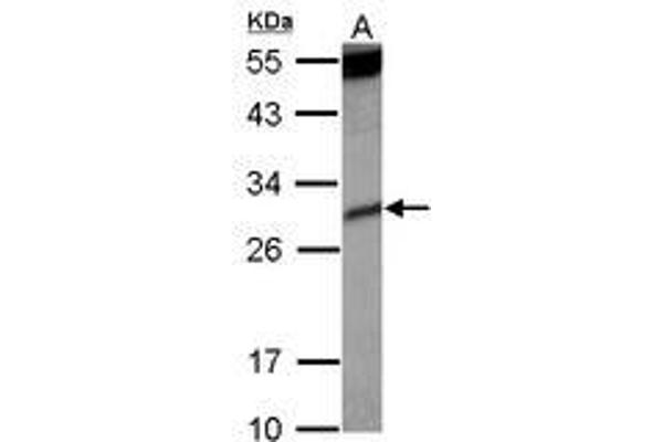 KIR2DS4 Antikörper  (AA 1-294)