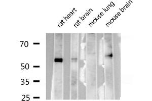 Western blot analysis of RUNX2 expression in various lysates (RUNX2 Antikörper  (Internal Region))