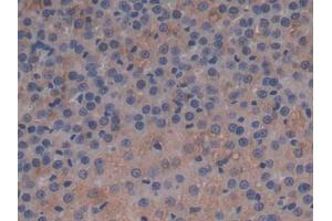 DAB staining on IHC-P; Samples: Rat Adrenal gland Tissue (APOC1 Antikörper  (AA 34-88))