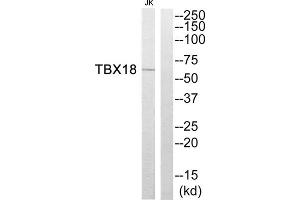 Western blot analysis of extracts from Jurkat cells, using TBX18 antibody. (T-Box 18 Antikörper  (Internal Region))