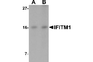 Western blot analysis of IFITM1 in Jurkat cell lysate with IFITM1 antibody at (A) 2. (IFITM1 Antikörper  (C-Term))