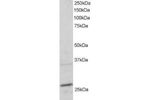 ABIN184807 staining (2µg/ml) of mouse heart lysate (RIPA buffer, 30µg total protein per lane). (RAB11A Antikörper  (C-Term))