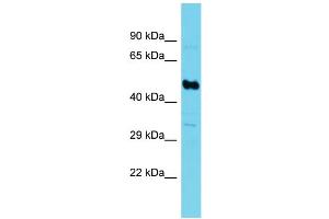 Western Blotting (WB) image for anti-Succinate-CoA Ligase, GDP-Forming, beta Subunit (SUCLG2) (N-Term) antibody (ABIN2790591)