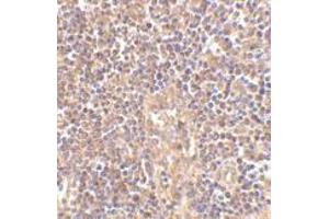 Immunohistochemistry of ATM in human lymph node tissue with this product atM antibody at 2. (ATM Antikörper  (C-Term))